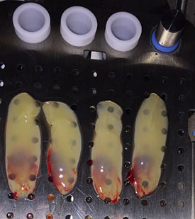 PRF samples