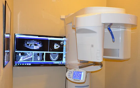 Sirona XG 3D-Scan