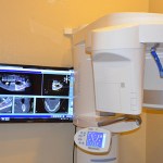 Sirona XG 3D-Scan